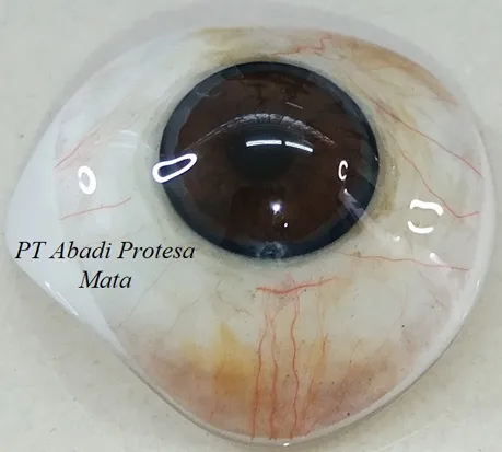sklera abadi protesa mata, mata palsu