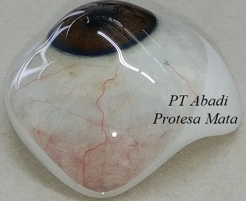 sklera abadi protesa mata, mata palsu