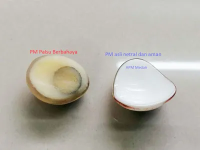 perbandingan protesa mata palsu dan protesa mata asli perbandingan protesa mata palsu dan protesa mata asli